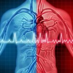 Cardiac Arrest