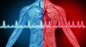Cardiac Arrest
