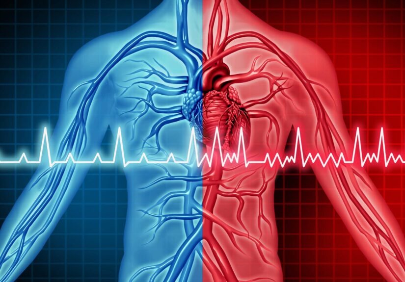 Cardiac Arrest